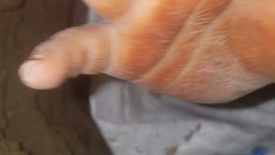 تصویر پس از ۹۲ ساعت عملیات نجات، حیدر کوچک از چاه بیرون آورده شد