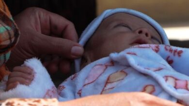 Afgan Kızılayı, kalp deliği olan 11.000 çocuğu kaydetti fotoğrafı