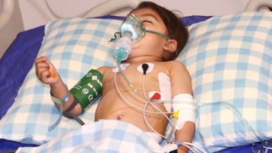 Photo of Afghan Red Crescent: Treatment of children with heart defects is carried out within the country