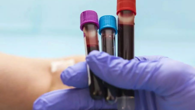 تصویر آزمایش خون جدید هاروارد: تشخیص سرطان سر و گردن تا ۱۰ سال زودتر 