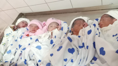 تصویر تولد پنجقلو در ولایت بلخ؛ یک مادر پنج کودک به دنیا آورد