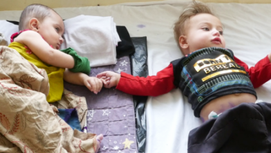 Photo of More Than 644,000 Children Treated for Diarrhea Across Afghanistan
